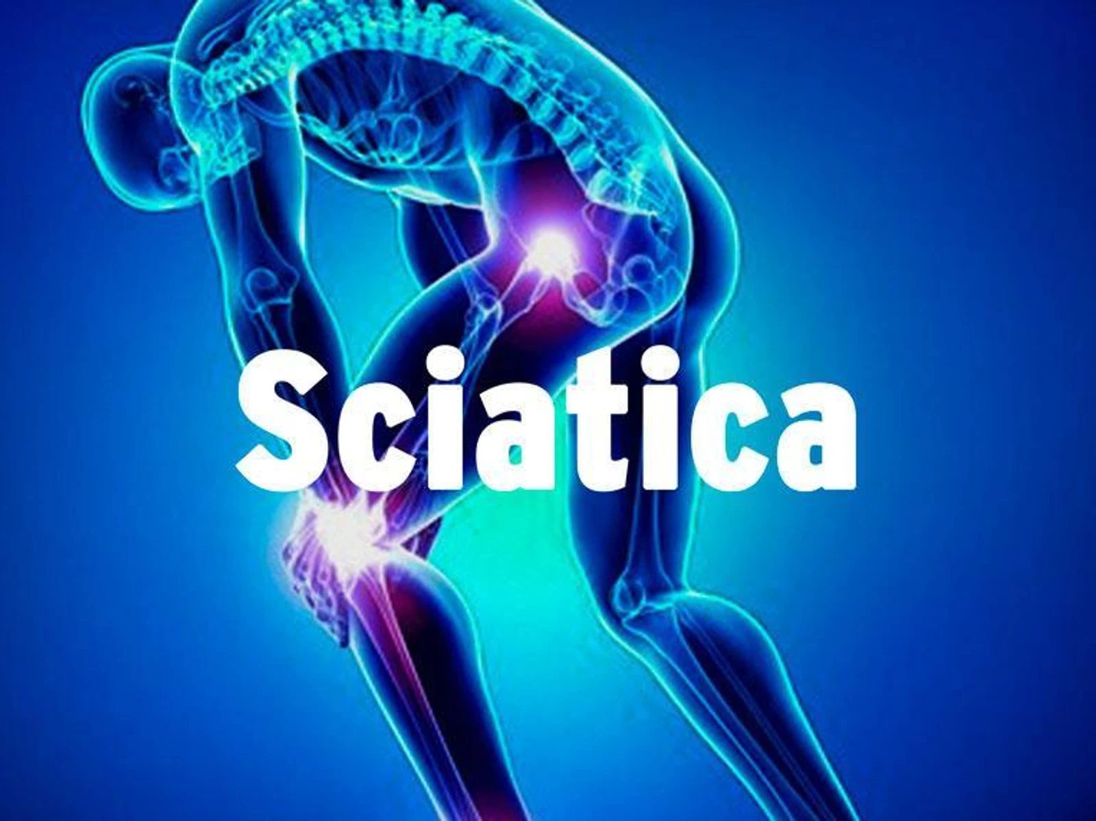 How Do I Know If I Have Sciatica? This Simple Test Can Tell You